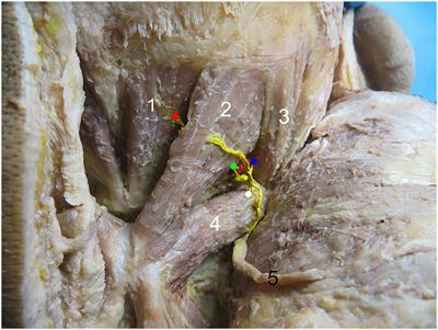 Localization of the Center of the Intramuscular Nerve Dense Region of the Suboccipital Muscles: An Anatomical Study